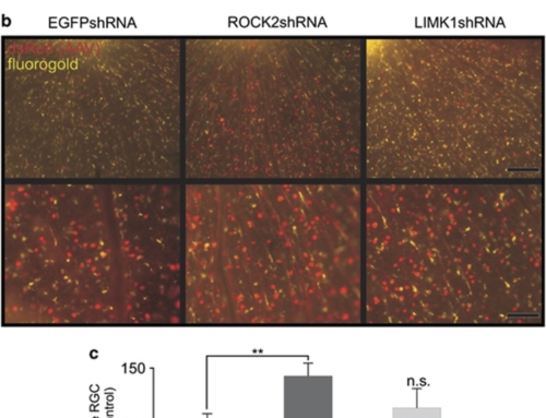 ROCK2 is a major regulator of axonal degeneration, neuronal death and axonal regeneration in the CNS