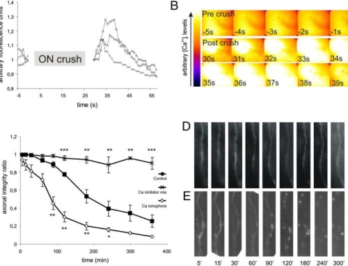 Mechanisms of acute axonal degeneration in the optic nerve in vivo